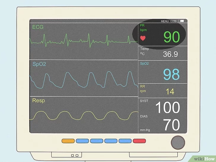 ICU Monitor Reader